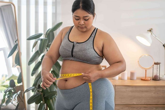 Obese Person