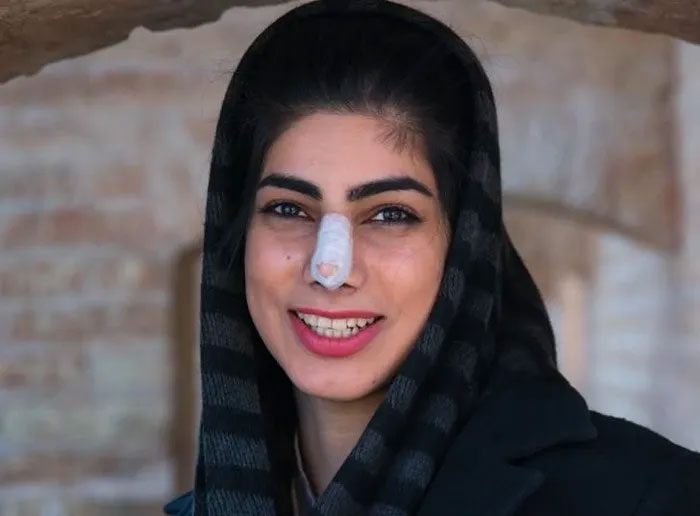 Wrapping bandages around the nose in Iran