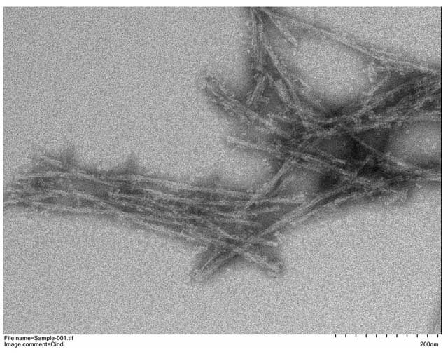 Moreover, the association of prions with other diseases is still under investigation.
