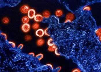 scientists discover a genetic variant that may reduce hiv infection 129253
