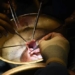 second patient in the world receives heart transplant 130210