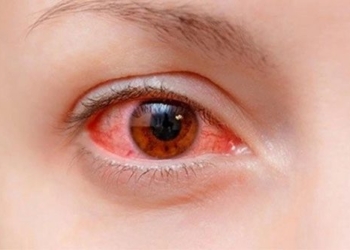 seeing the sick person is it inconvenient 129821