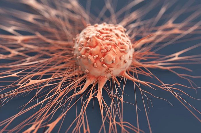 Formaldehyde is associated with several types of cancer.