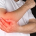 tennis elbow symptoms causes and treatment 131209