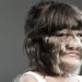 the girl with the rare disease only 50 people in the world have been born with it at adulthood 131313