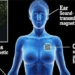 the woman puts 52 chips in her body to replace the keyphone 130916