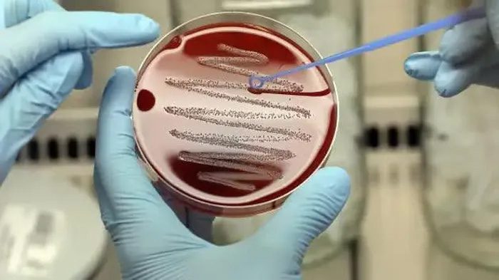 Misuse of antibiotics is the main cause of AMR.