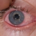 top 10 causes of dark circles and treatment 130222