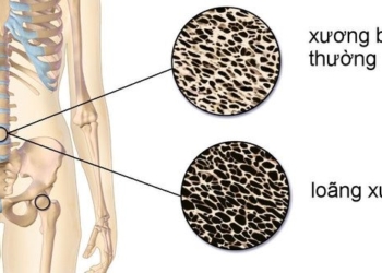 top 4 foods rich in calcium that make many people surprised about thin bones 130875