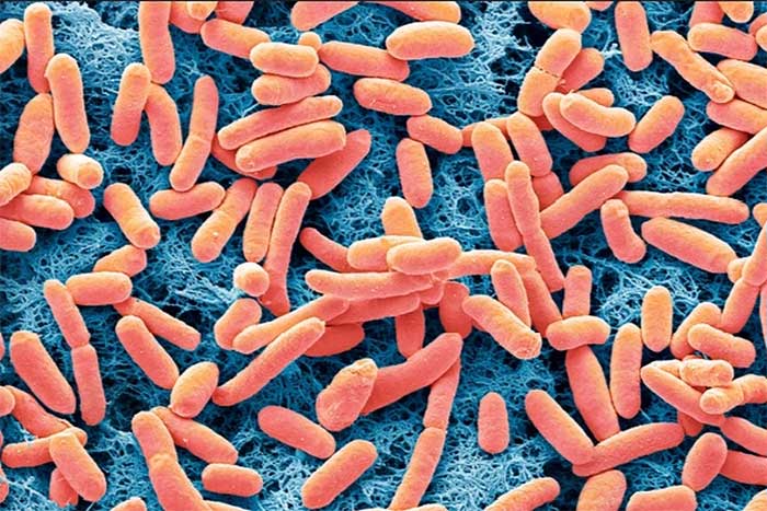 vi khuan e coli 1