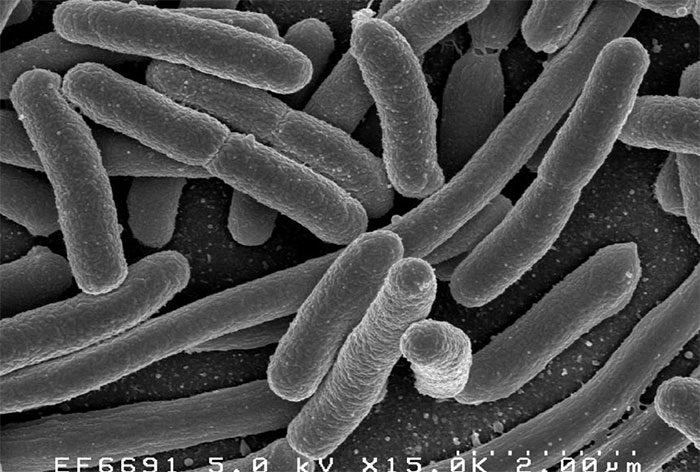 Microscopic image of E. coli bacteria.