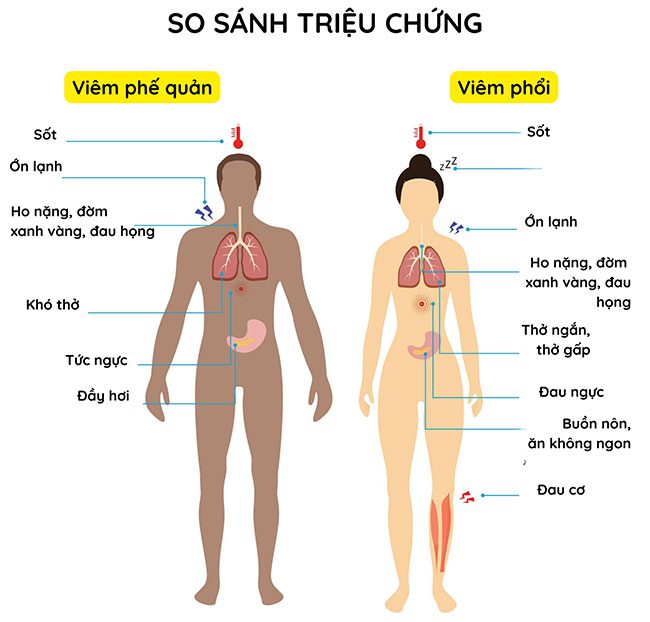 Distinguishing bronchitis symptoms from pneumonia