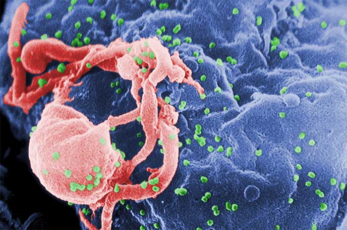 virus hiv 1