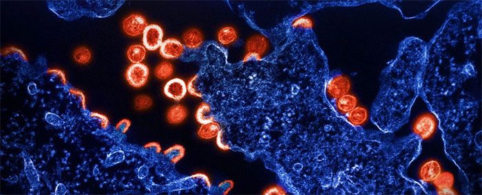 virus hiv