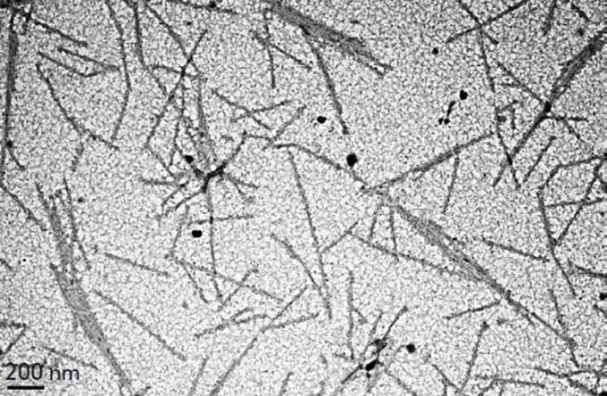 Tobacco mosaic virus under a transmission electron microscope (TEM).
