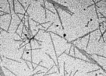 what is the first virus scientifically detected 130454