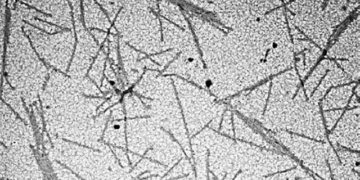 what is the first virus scientifically detected 130454