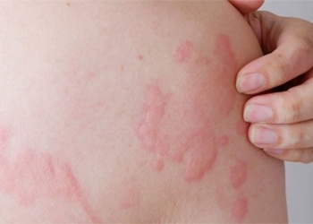 why our body can be allergic 131055