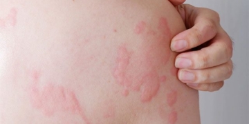 why our body can be allergic 131055