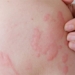 why our body can be allergic 131055