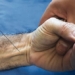 why some people do not have palmaris longus tendon in their hands 129737