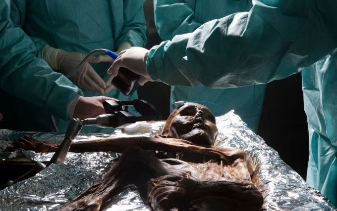 Researchers taking brain samples from the Ötzi mummy.