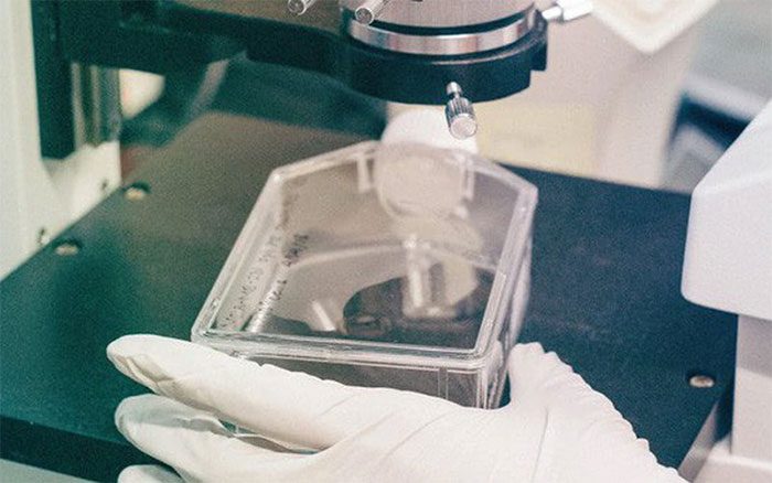 This is the first case in Vietnam of a fetus with a gene mutation