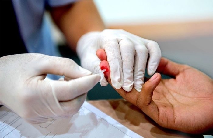 HIV testing through blood or bodily fluids.