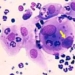 4 hard to bear diseases affecting men 5632