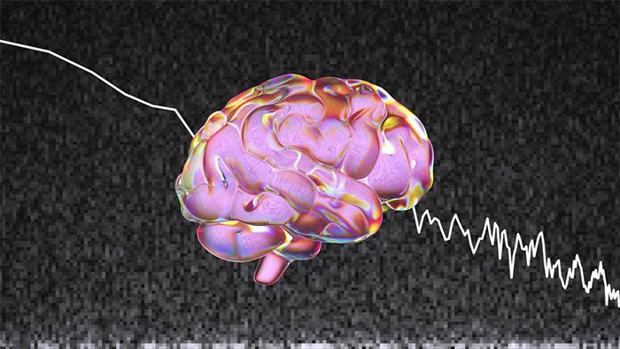 This AI model is called Mind-Vis