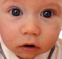 BabyEyes