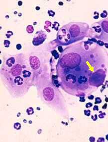 Chlamydia bacteria