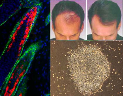 Elaine Fuchs' stem cell hair regeneration research