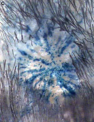 George Cotsarelis' stem cell research