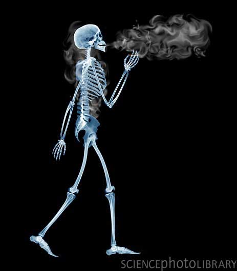 Skeleton1