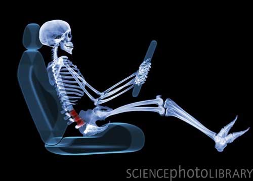 Skeleton3
