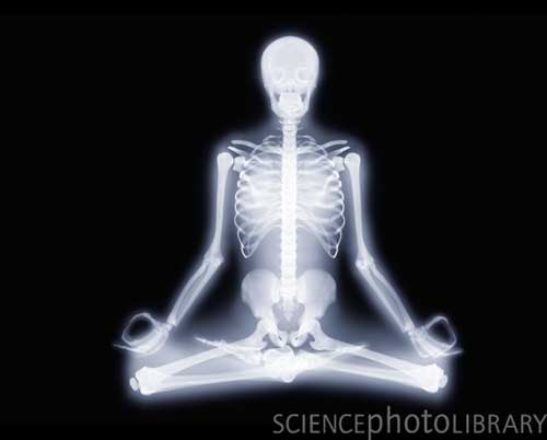 X ray1