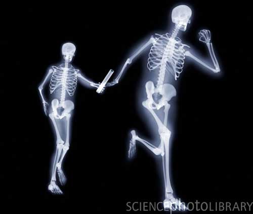 X ray4
