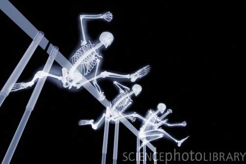 X ray5