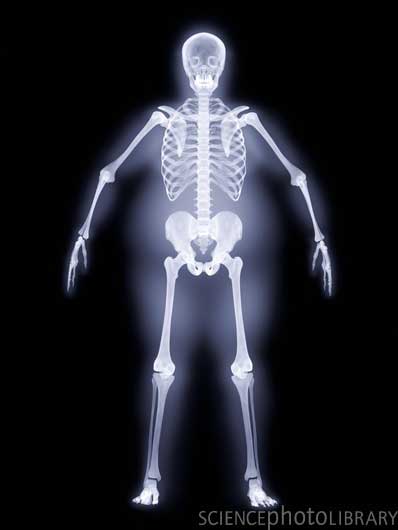 X ray6