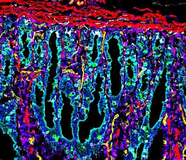 This is the first map of the human intestine.