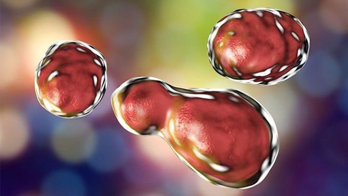 Illustration of fungal spores causing meningitis.