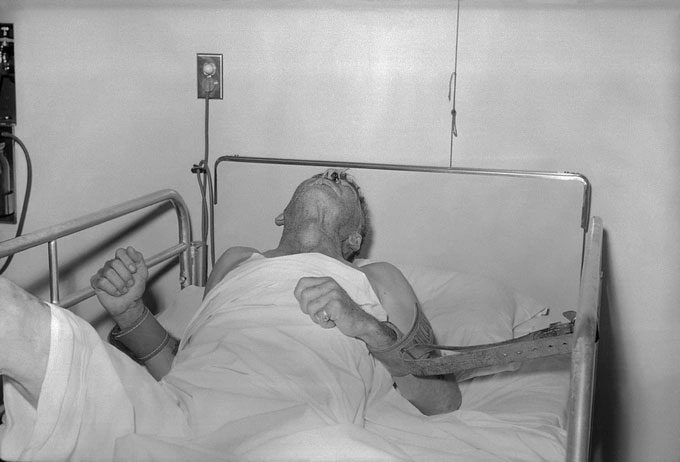 Patient experiencing rabies symptoms.
