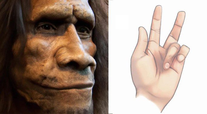 Some fingers bent may be due to a gene variant inherited from Neanderthal ancestors