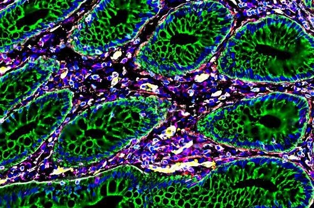 Close-up of proteins, bacteria, and immune cells.