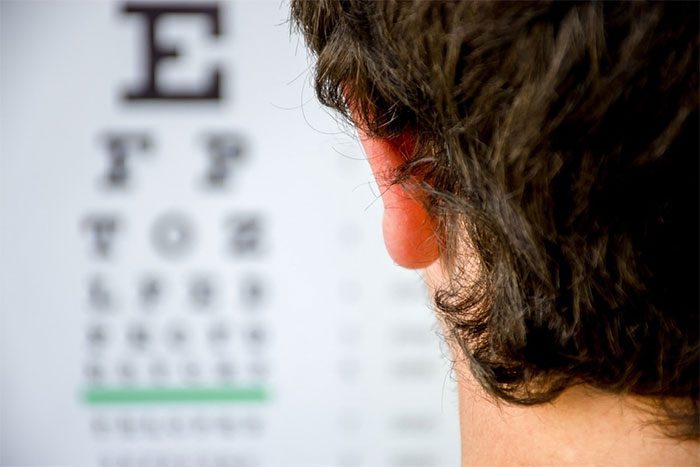 Genetics can influence whether a person is myopic or hyperopic.