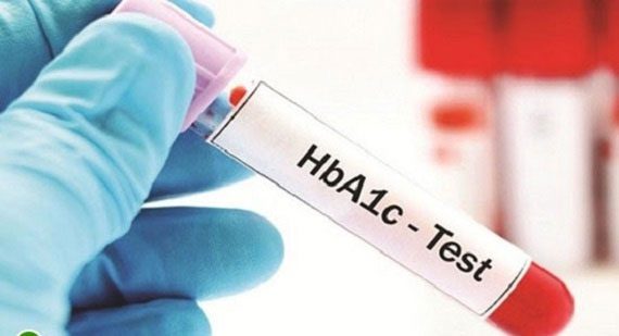 HbA1c Index Indicates Average Blood Sugar Over the Past 3 Months