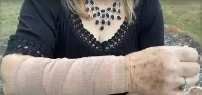 Aftermath of the attack by both the snake and the hawk.