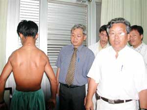 A case of Deltoid muscle fibrosis admitted to Chợ Rẫy Hospital on May 18