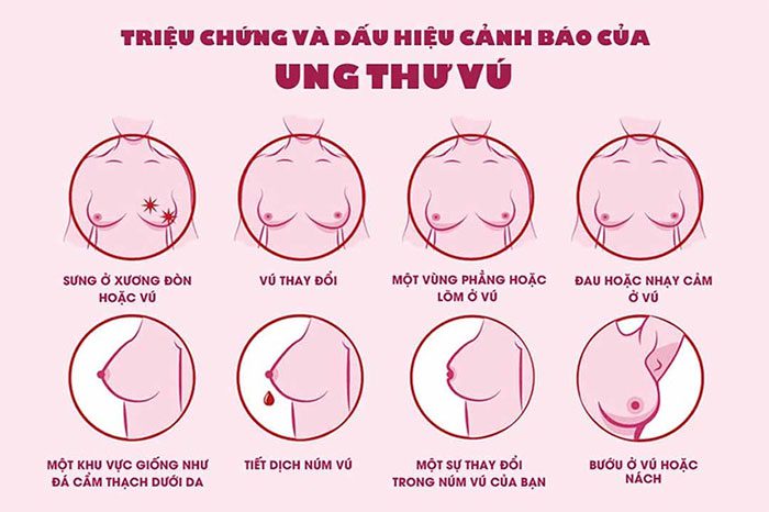 Breast cancer typically presents with the symptom of a lump in the breast tissue.